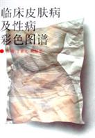 临床皮肤病及性病彩色图谱