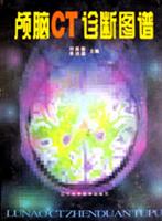 颅脑CT诊断图谱