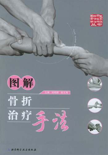 图解骨折治疗手法