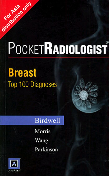 乳房的100个主要诊断