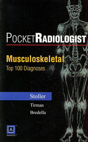 肌肉骨骼的100个主要诊断